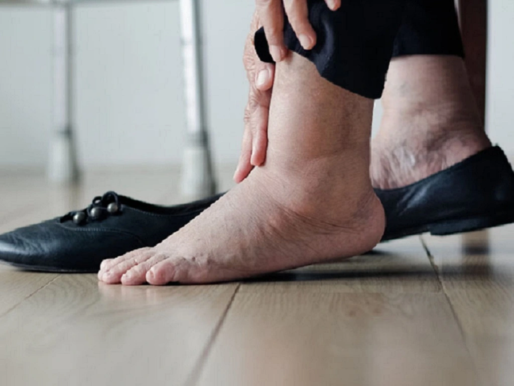 Thận yếu gây phù mắt cá chân vào buổi sáng