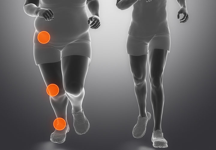 Minh họa áp lực lên khớp gối khi cơ thể thừa cân gây đau nhức và thoái hóa khớp

