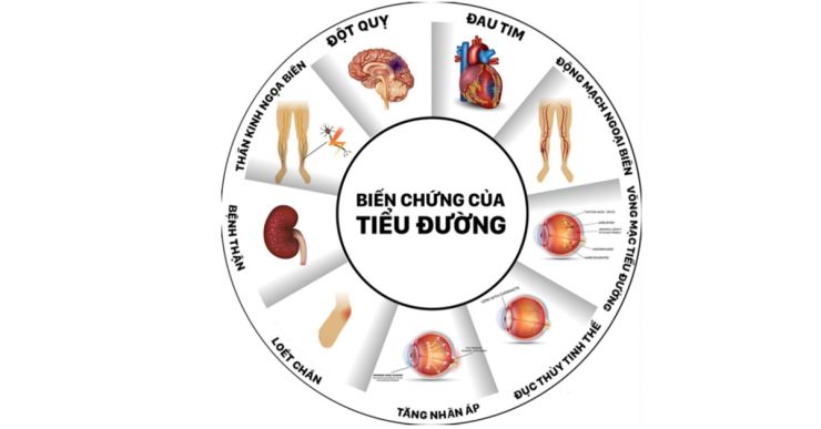 Các biến chứng nguy hiểm của tiền tiểu đường nếu không kiểm soát kịp thời
