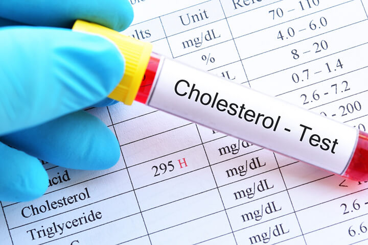 Các chỉ số lipid máu phổ biến cần theo dõi