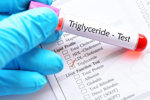 Chỉ số triglyceride cao