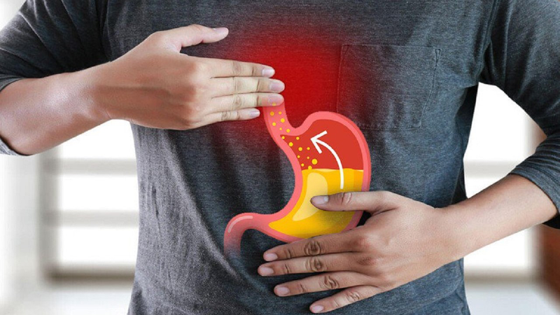Mẹo giảm trào ngược dạ dày