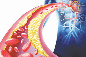 Triglyceride cao trong gia đình