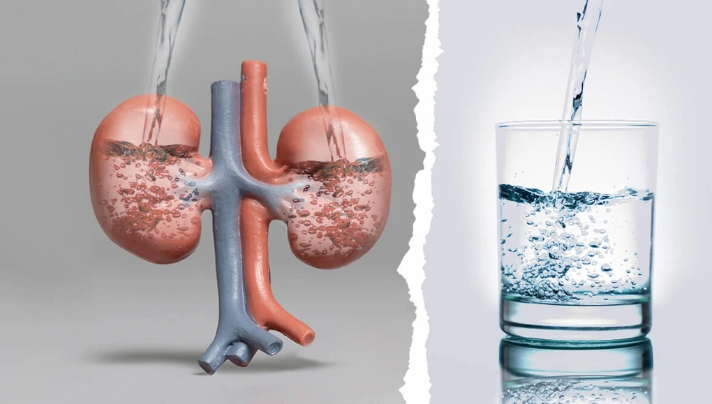 Cách uống nước để thận không quá tải