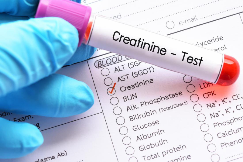 Xét nghiệm creatinin kiểm tra chức năng thận