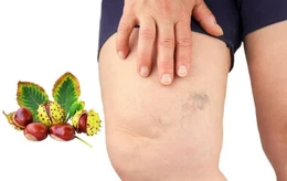 Bộ đôi hạt dẻ ngựa và rutin hỗ trợ cải thiện giãn tĩnh mạch 