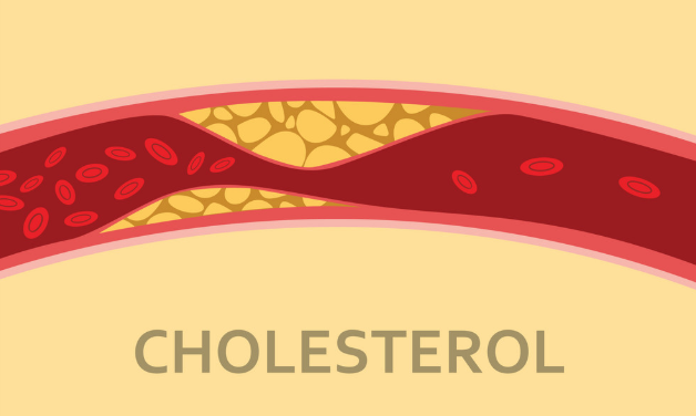 Cholesterol là gì