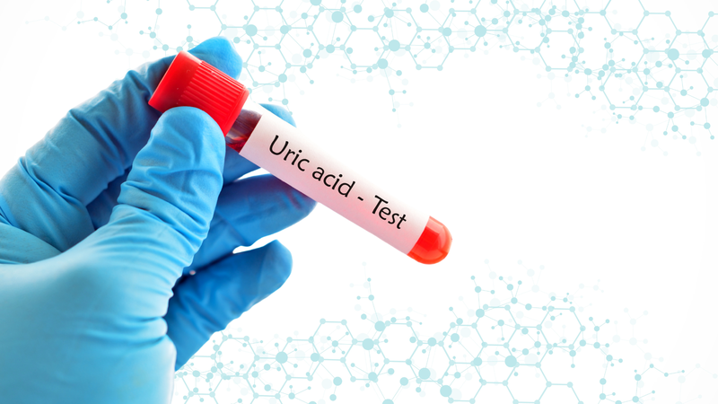 Kiểm soát acid uric định kỳ