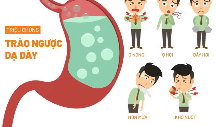 Các triệu chứng thường gặp của trào ngược dạ dày như ợ nóng, rát cổ, buồn nôn
