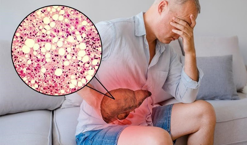 Biến chứng của men gan cao