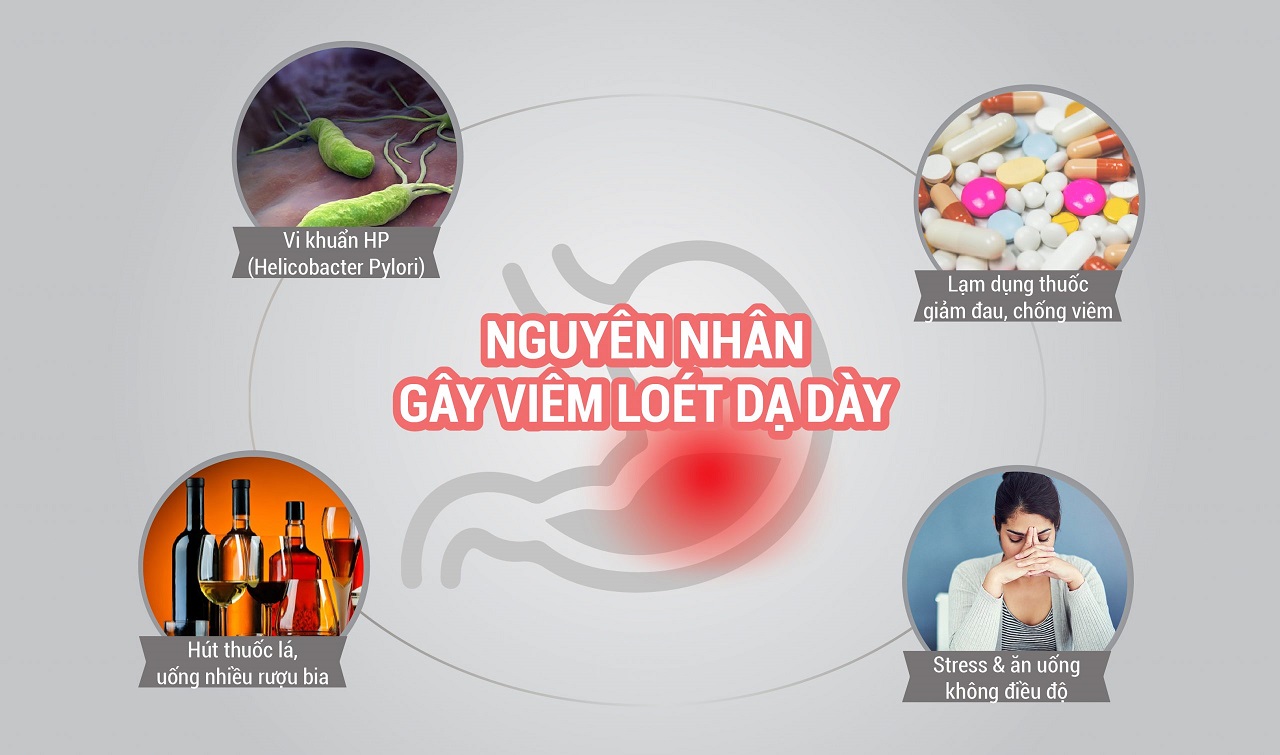 Ba nguyên nhân chính gây viêm loét dạ dày thường gặp ở người Việt