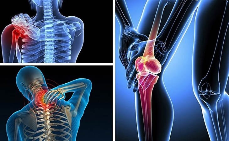 Thoái hóa khớp, đau khớp gối