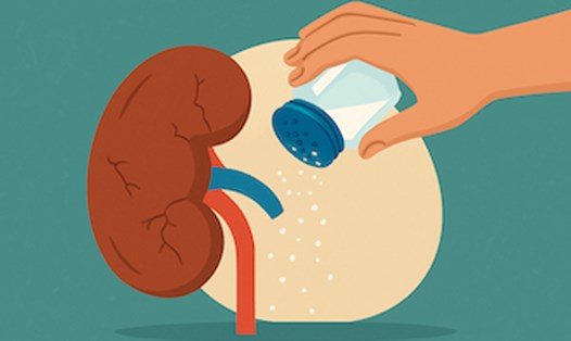 Thói quen gây hại cho sức khỏe thận như ăn mặn