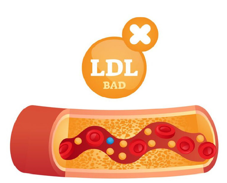 LDL cholesterol giúp tạo màng tế bào, hormone, vitamin D