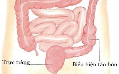 Cơ chế hoạt động của đại tràng bình thường và khi bị táo bón do IBS-C