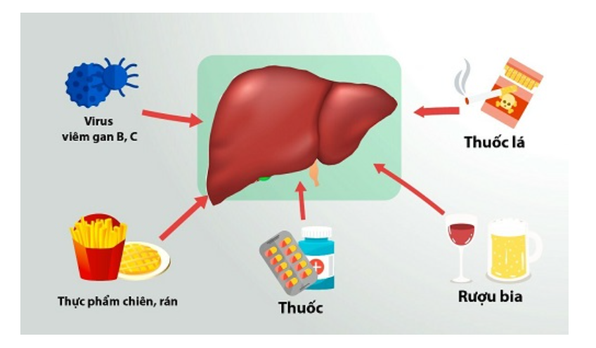 Nguyên nhân men gan tăng thường gặp