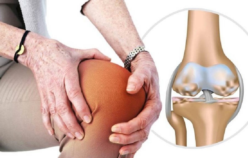 Đau nhói và cứng khớp là dấu hiệu sớm của thoái hóa khớp gối