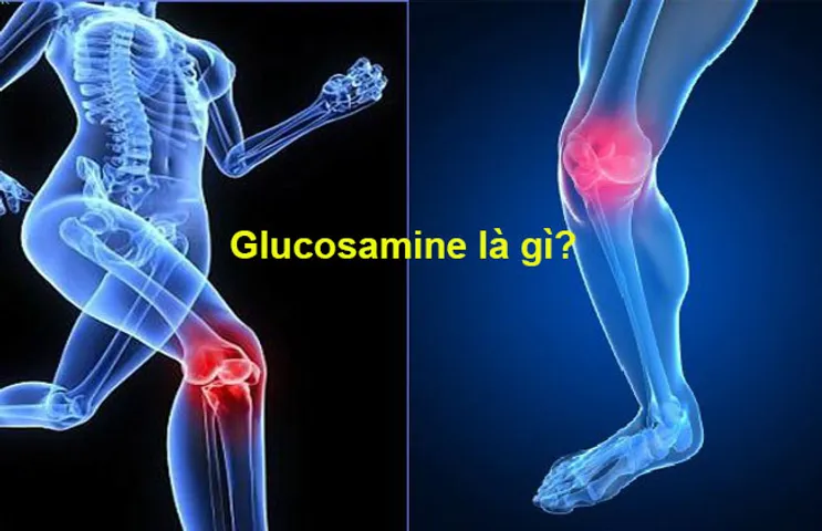 Glucosamine giúp hỗ trợ sụn khớp trong thoái hóa khớp gối