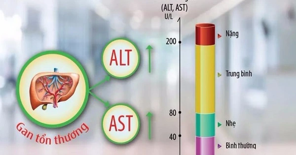 Hình ảnh mô tả men gan cao là gì và các chỉ số ALT AST vượt ngưỡng