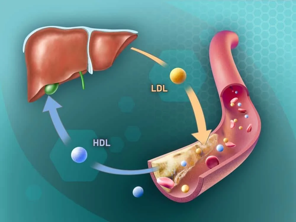 gan sản xuất cholesterol và triglyceride gây mỡ máu cao