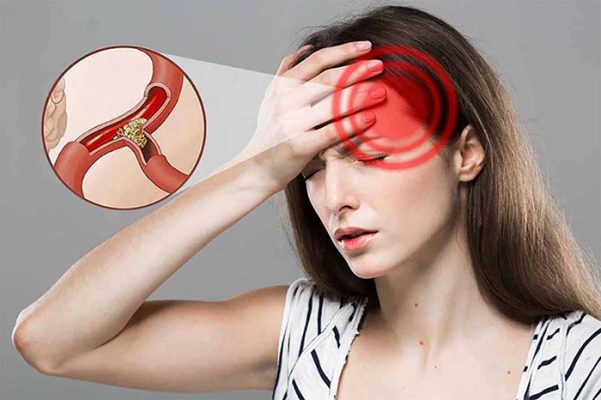 Thiếu máu não gây nặng đầu và chóng mặt vào buổi sáng
