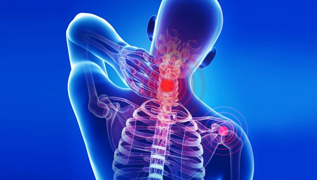 Thiếu máu não do thoái hóa đốt sống cổ chèn ép mạch máu vùng cổ