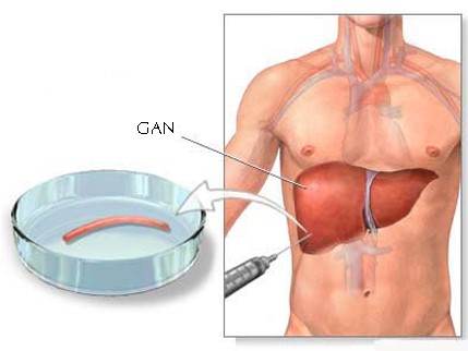 FibroScan giúp kiểm tra gan nhiễm mỡ và xơ hóa gan