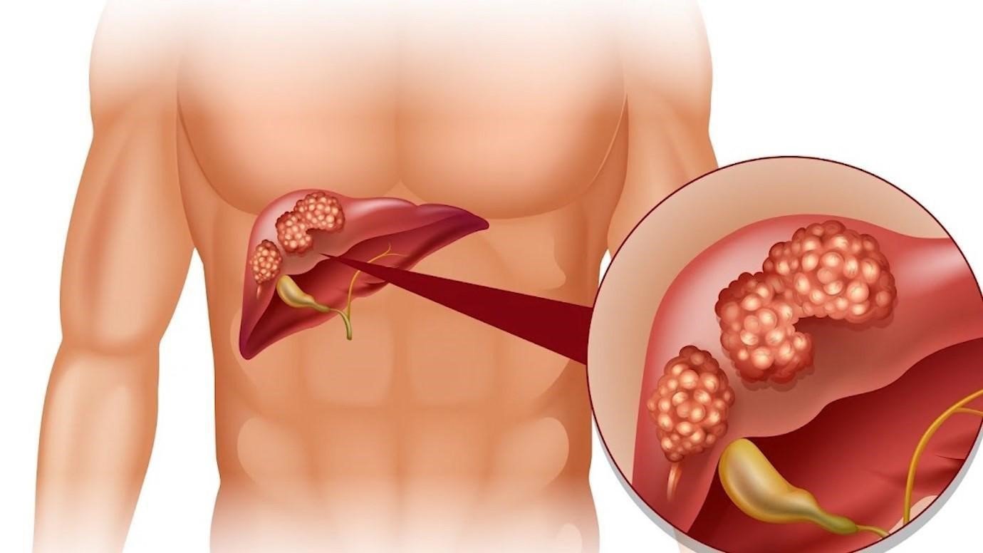 Gan yếu khiến tỉnh giấc giữa đêm 