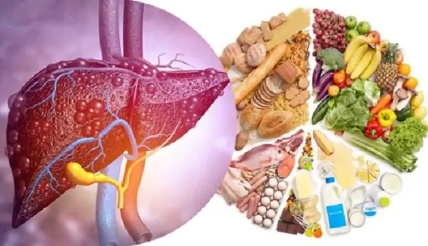 Trị gan nhiễm mỡ hiệu quả với kiềng ba chân ăn uống vận động và giảm cân