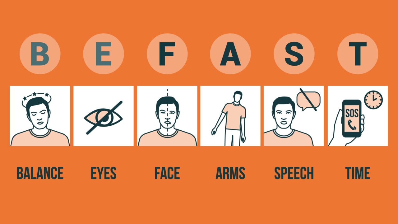 Quy tắc BE FAST nhận biết sớm dấu hiệu đột quỵ