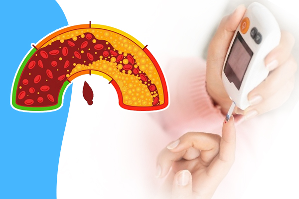 Kháng insulin có liên quan đến mỡ máu cao, tiểu đường, béo bụng, tăng huyết áp và gút