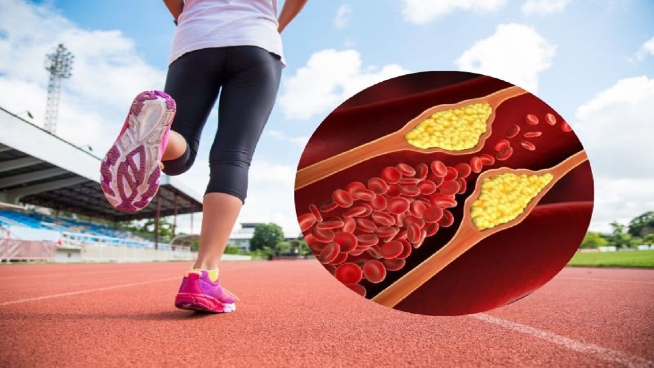 Thể dục là nền tảng quan trọng với người mỡ máu cao 