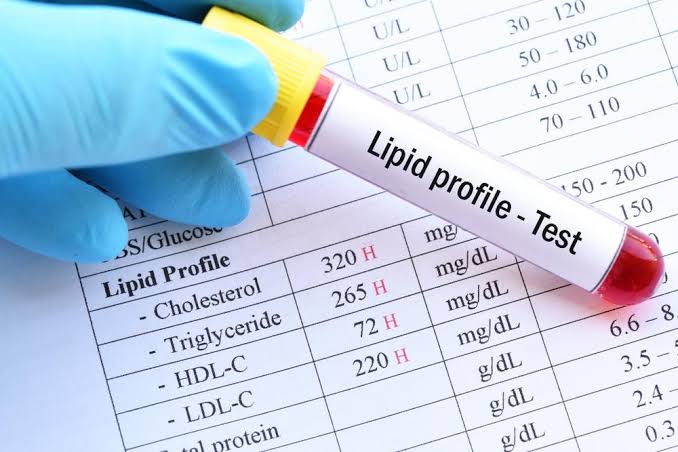 Bốn chỉ số cần theo dõi khi dùng thuốc mỡ máu gồm cholesterol toàn phần LDL HDL và triglyceride